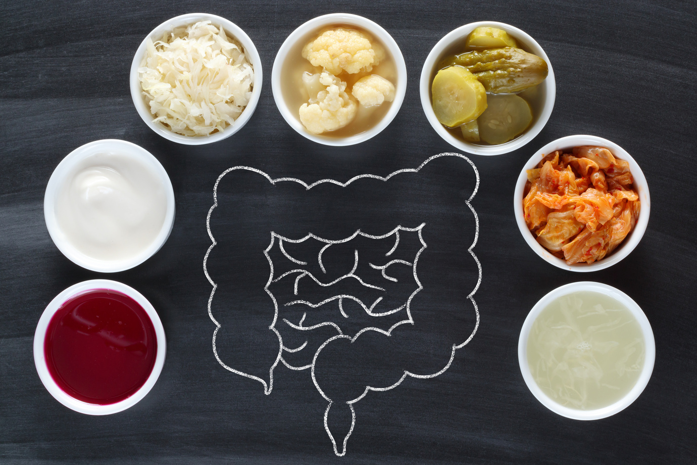 Probiotics for healthy gut
